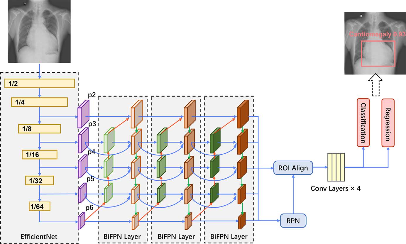 One paper was accepted in Radiology AI