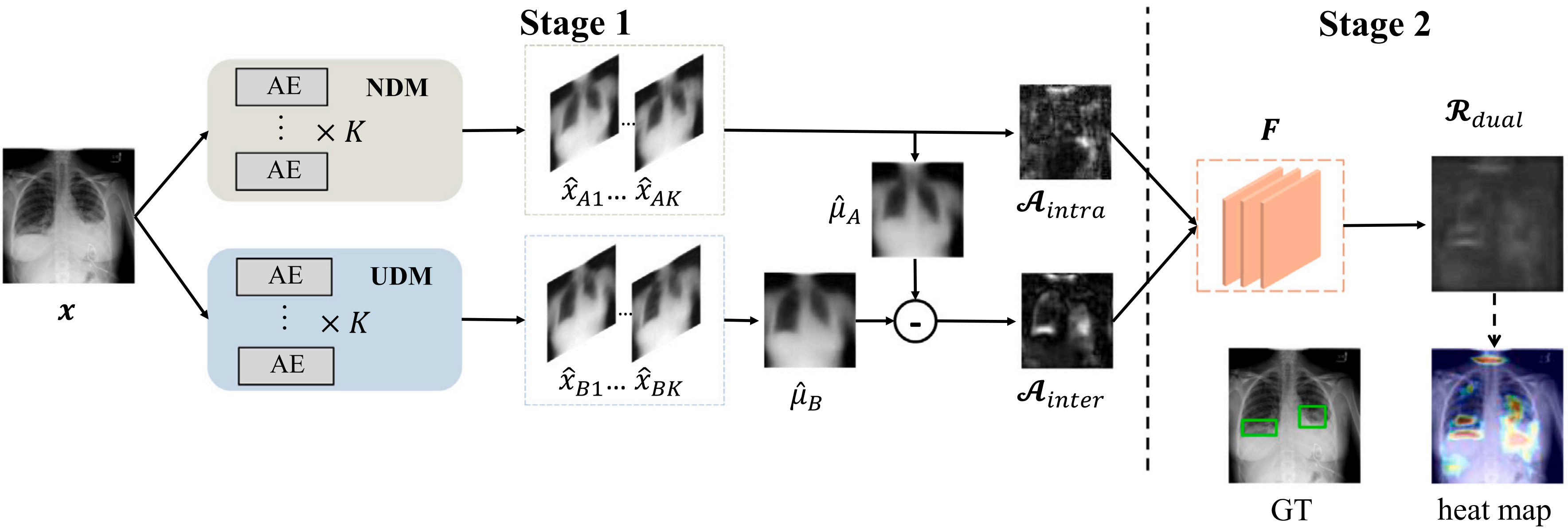 One paper was accepted in Medical Image Analysis