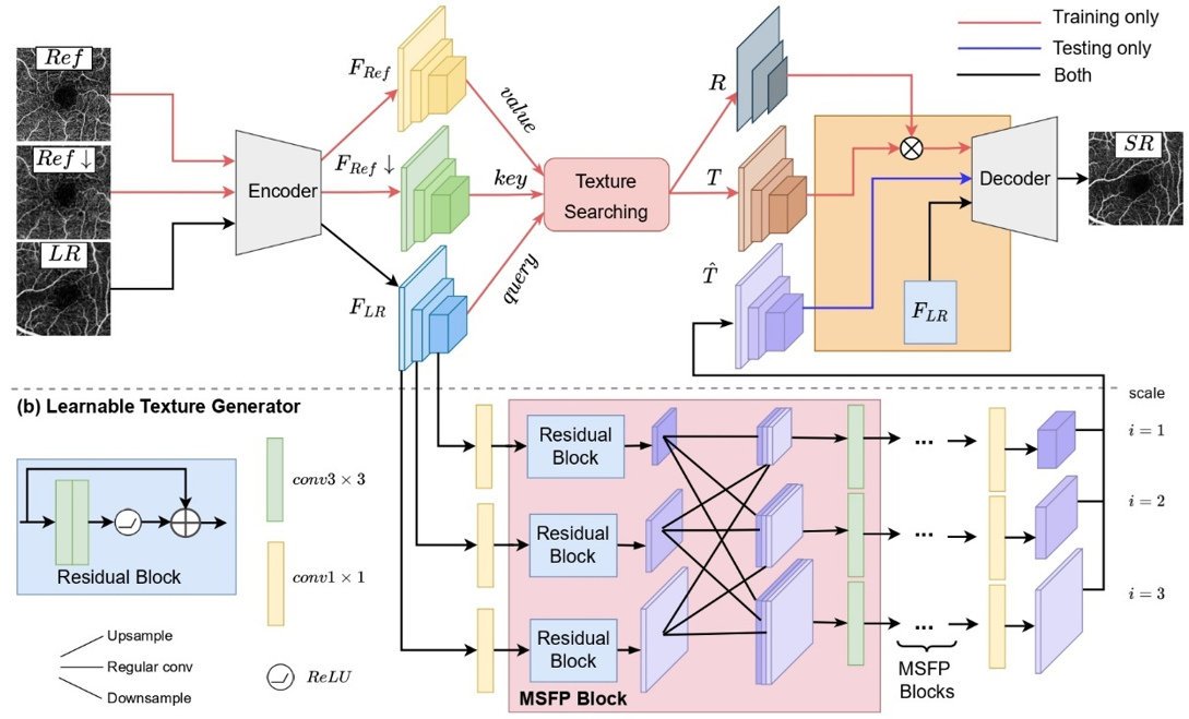 [IEEE-TNNLS] Reference-based OCT Angiogram Super-resolution with Learnable Texture Generation