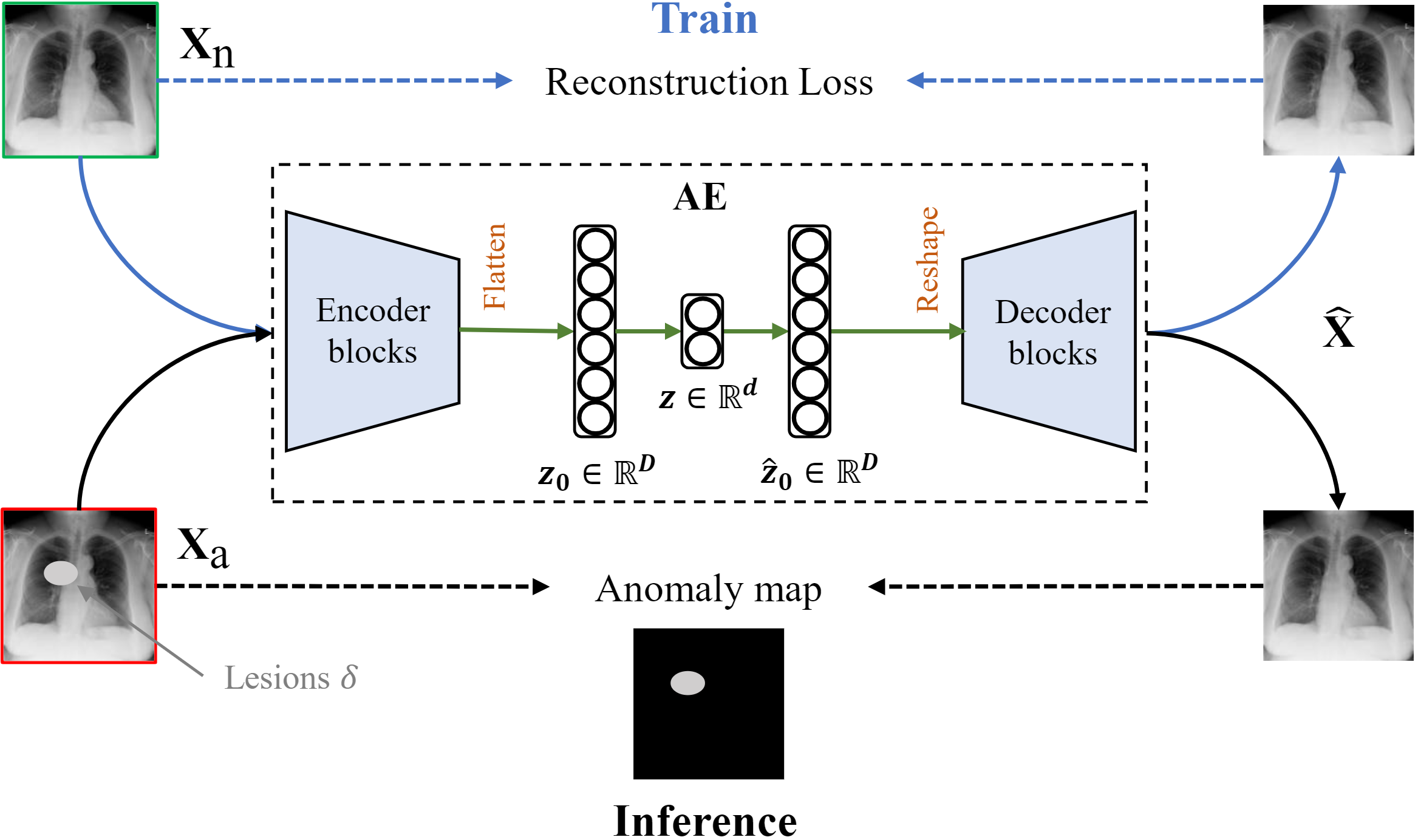 [MICCAI 2024 Paper] Rethinking Autoencoders for Medical Anomaly Detection from A Theoretical Perspective