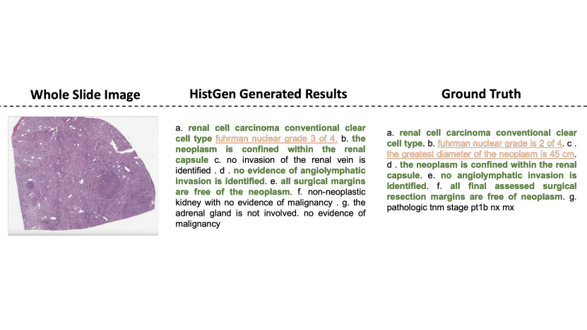 [MICCAI 2024 Paper] Histopathology Report Generation via Local-global Feature Encoding and Cross-modal Context Interaction