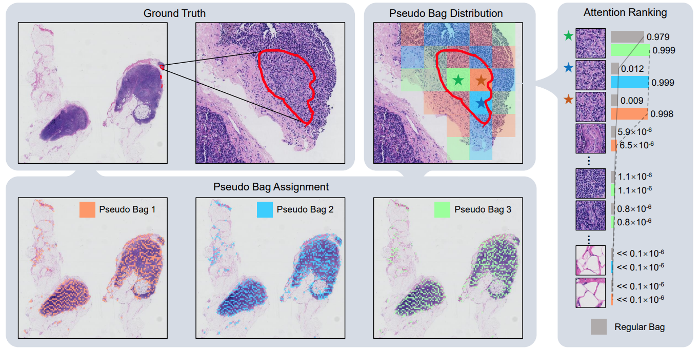[IEEE-TMI] Shapley Values-enabled Progressive Pseudo Bag Augmentation for Whole Slide Image Classification
