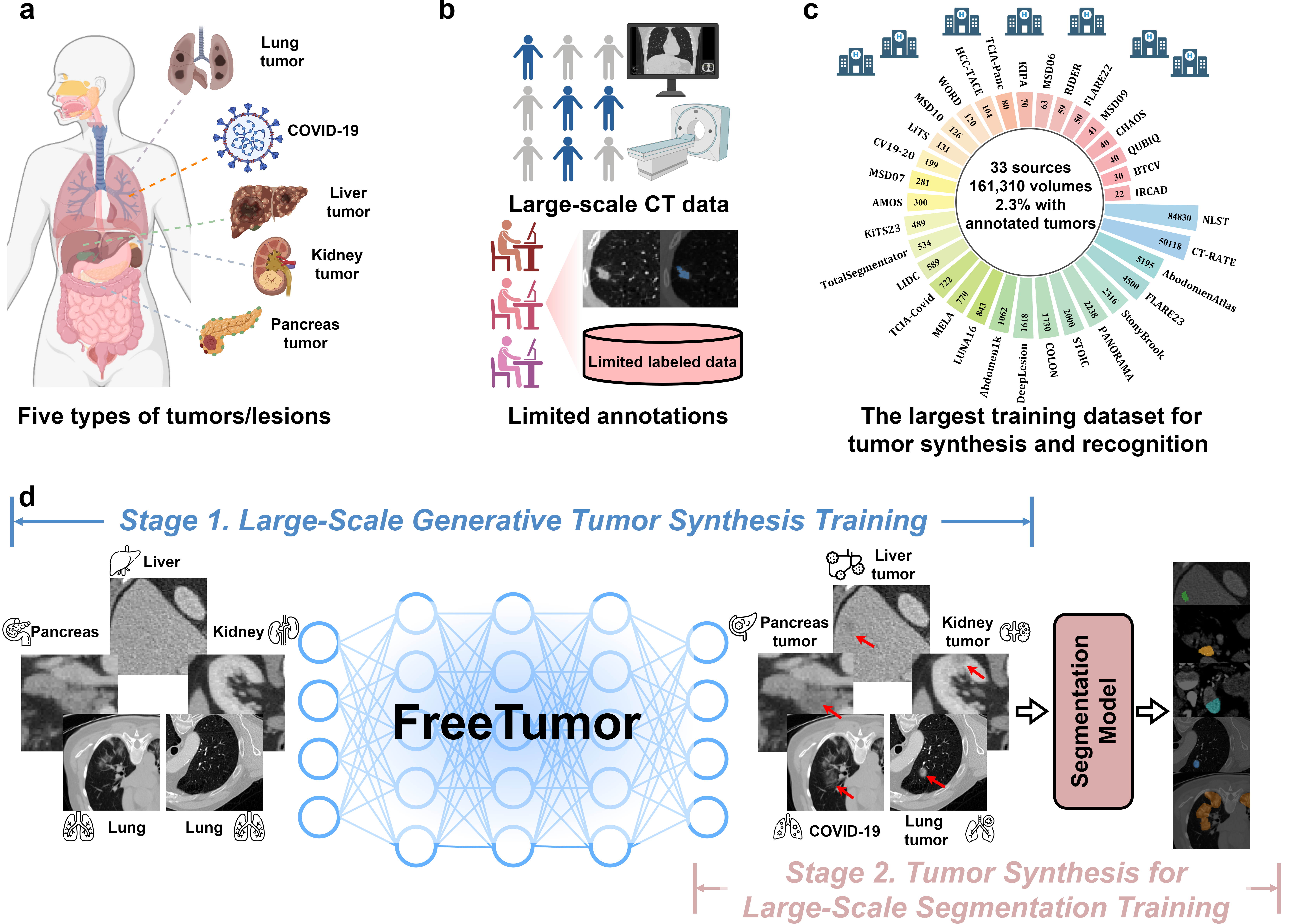 [Nature Communications] Large-scale generative tumor synthesis in computed tomography images for improving tumor recognition