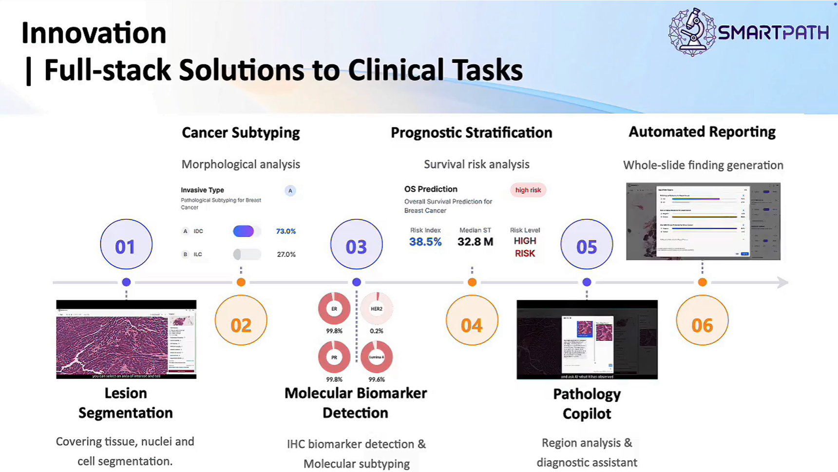 SmartPath Features and Workflow