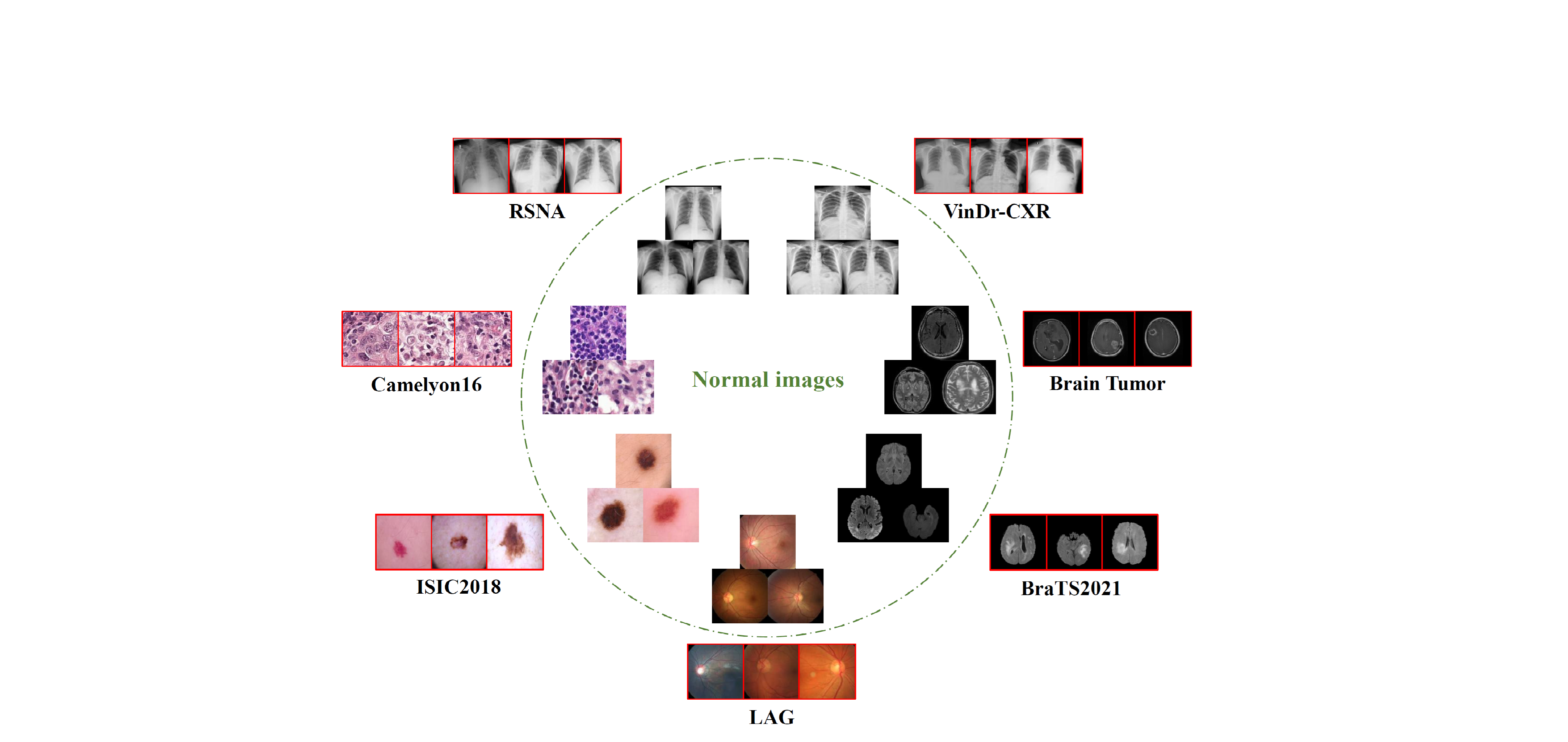 [MIA2025] MedlAnomaly: A Comparative Study of Anomaly Detection in Medical Images