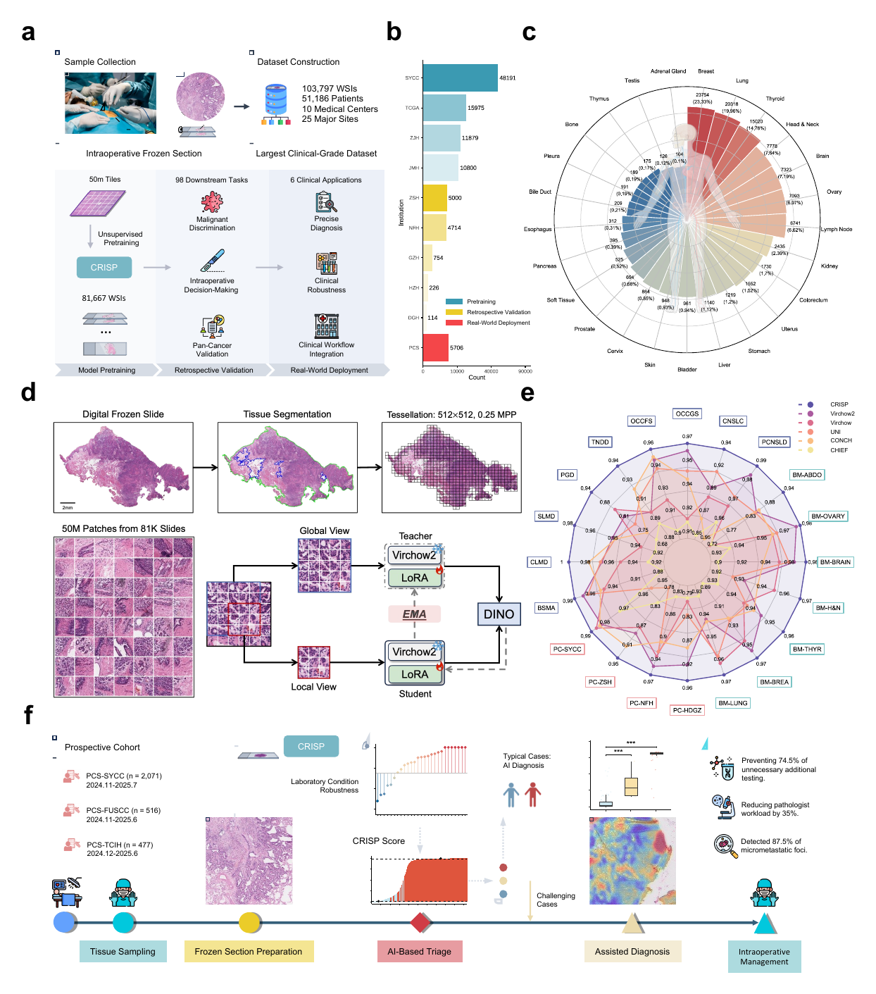 CRISP multicentre cohort, model development, evaluation, and prospective clinical workflow