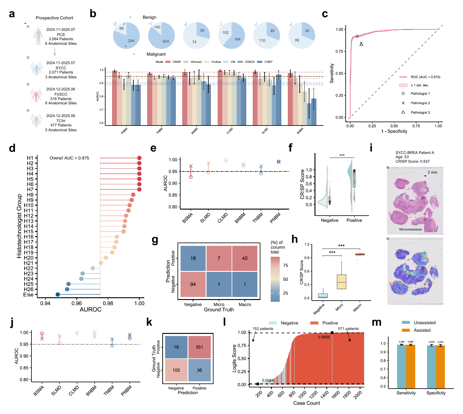 Prospective clinical validation and human-AI collaboration with CRISP