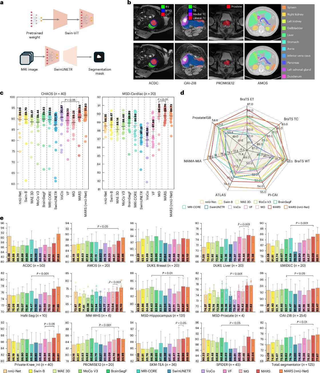 MARS results on organ and lesion segmentation