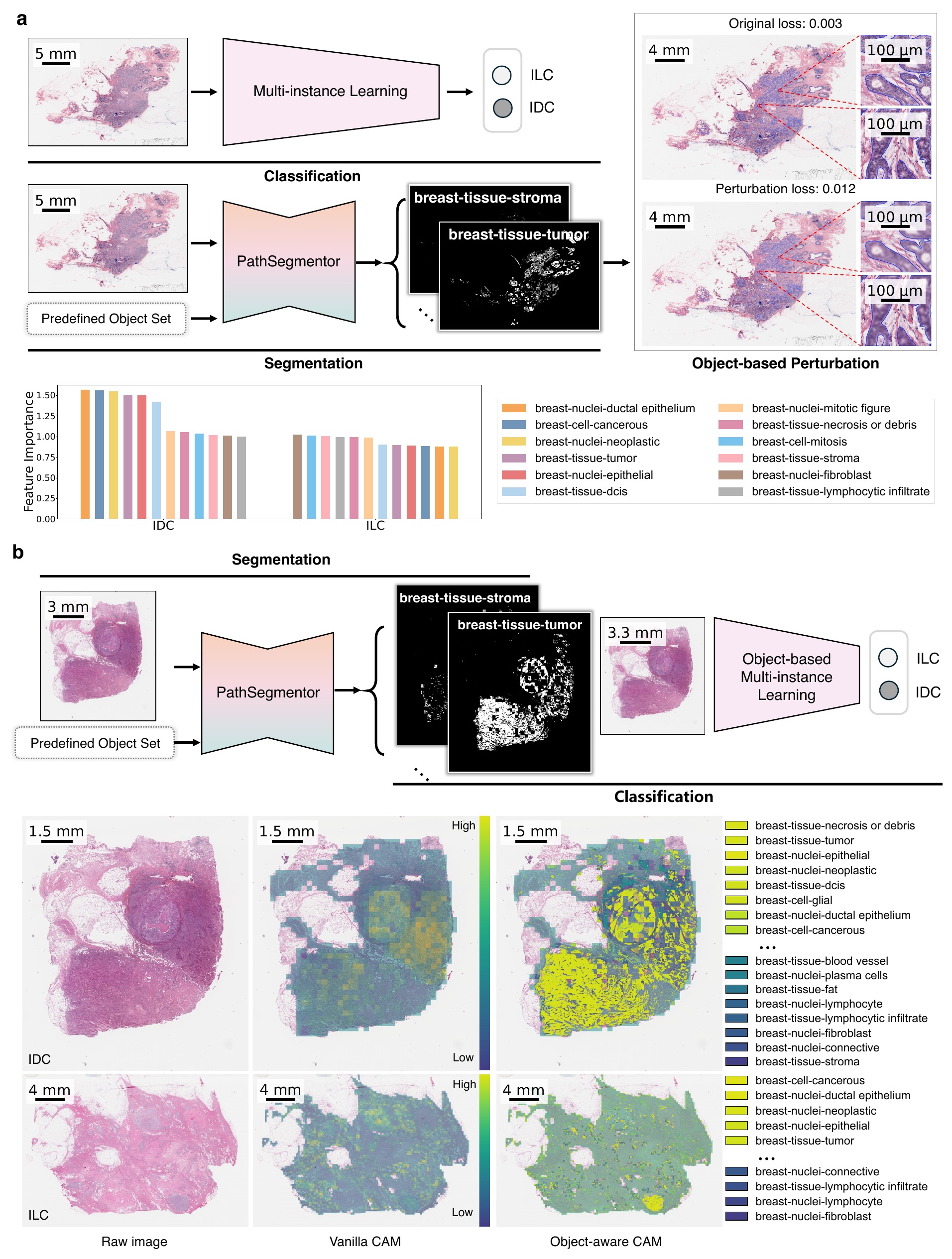 PathSegmentor for interpretable breast cancer classification