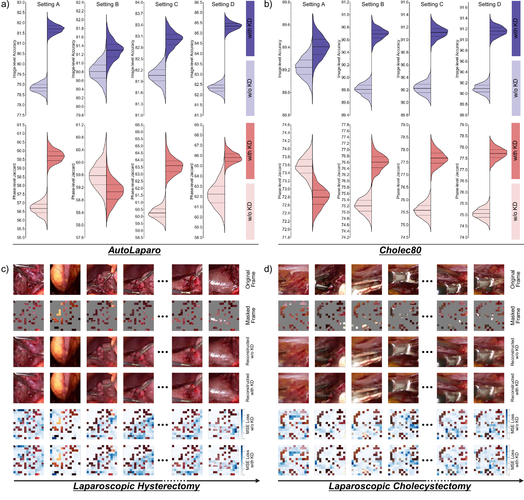 Fig. 6. Ablation analysis of image-level knowledge distillation in SurgVISTA